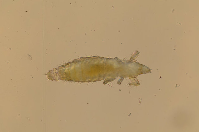 Представитель Семейства Eosentomidae